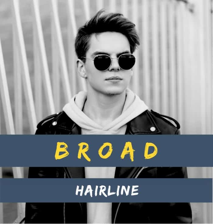 Broad Hairline