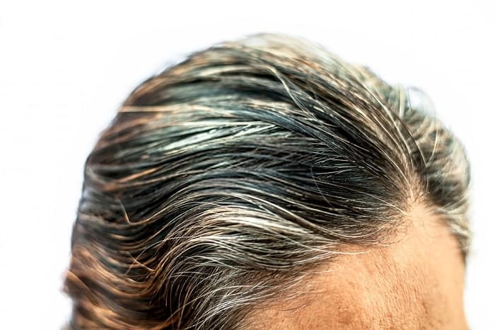 how to get rid of premature gray hair