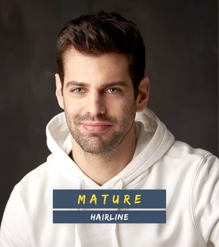 6 Types of Hairlines for Men – Cool Men's Hair