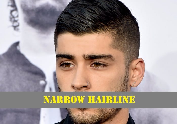 6 Types of Hairlines for Men – Cool Men's Hair