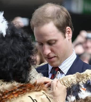 Prince William hair loss picture.