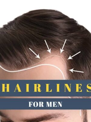 6 Types of Hairlines for Men