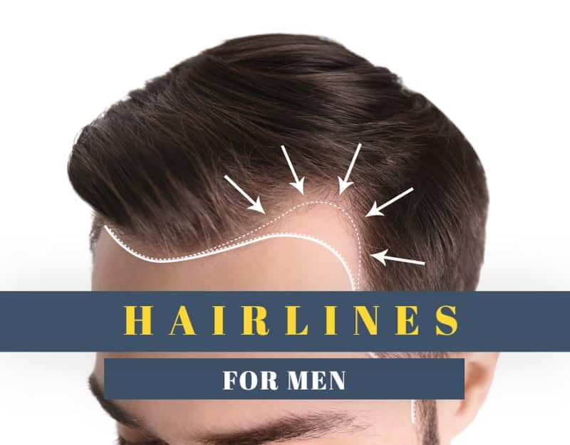 6 Types of Hairlines for Men – Cool Men's Hair