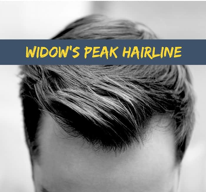 Widow's Peak Hairline