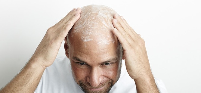 apply moisturizer to get shiny bald head