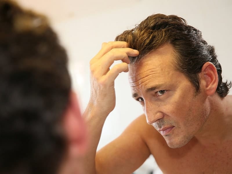 reducing hair loss for men over 40