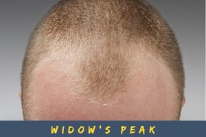 The Best Haircuts for Widow’s Peak