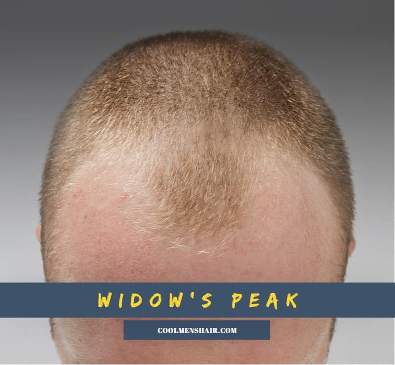 widow's peak